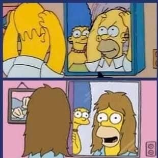 1 ano de minoxidil pro noivo não ficar calvo